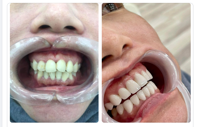 Sự uy tín của tay nghề bác sĩ Delia luôn được khẳng định và chứng thực bởi kết quả cuối cùng.