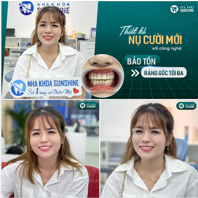 Sunshine – Nha khoa sở hữu công nghệ độc quyền này khiến cho 10/10 khách hàng hài lòng tuyệt đối sau khi trải nghiệm.