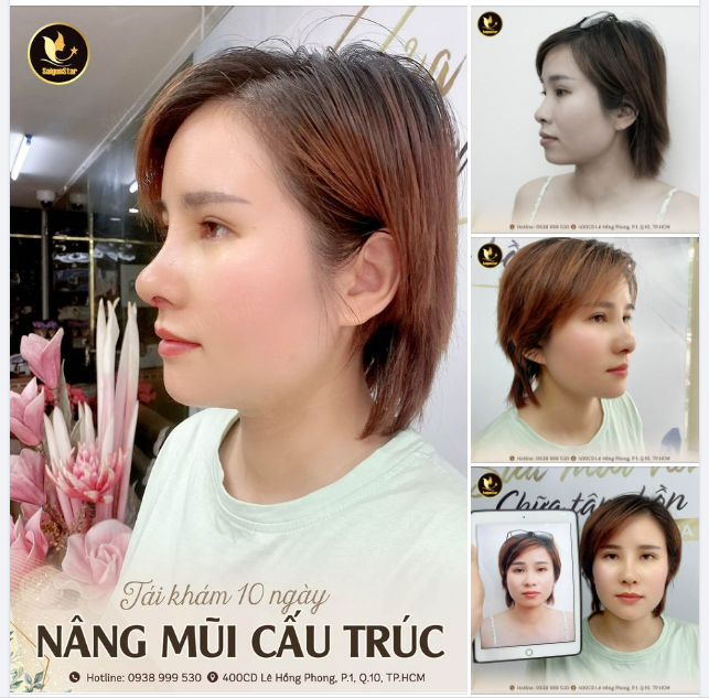 TÁI KHÁM 10 NGÀY – XINH ĐẸP CHÍNH LÀ ĐẶC QUYỀN