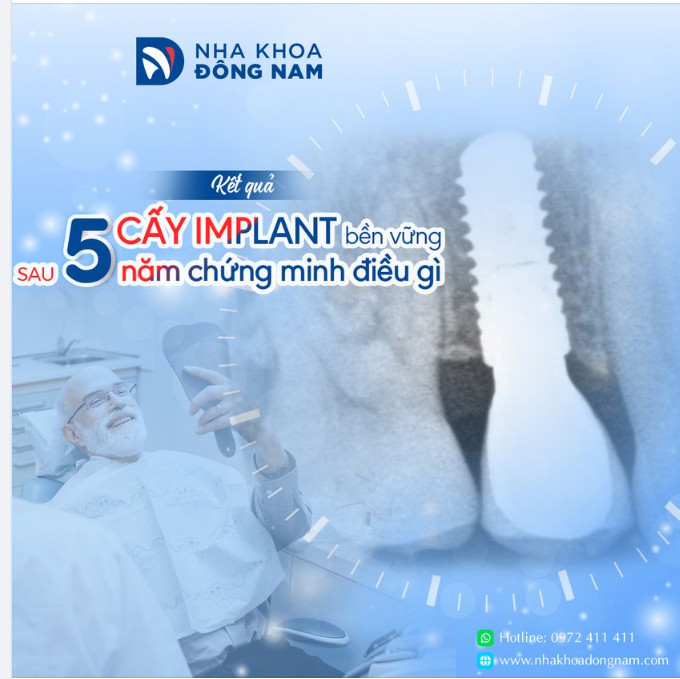 TÁI KHÁM RĂNG IMPLANT SAU 5 NĂM