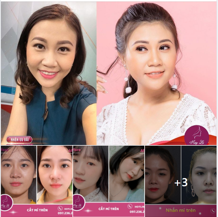 TẠM BIỆT SỤP MÍ - MẮT TO TRÒN NHƯ Ý