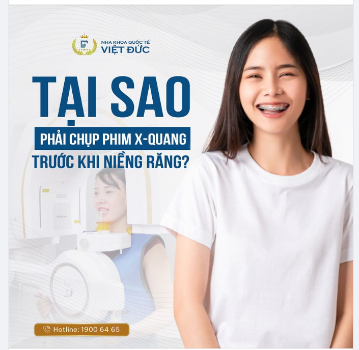 TẦM QUAN TRỌNG CỦA CHỤP PHIM X-QUANG TRƯỚC KHI NIỀNG RĂNG