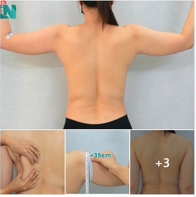 TẠO DÁNG CÂN CHỈNH CƠ THỂ CHO CHỊ KH 38 TUỔI, ĐÃ TẬP THỂ THAO NHIỀU NĂM 