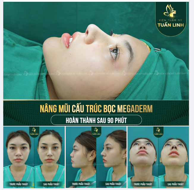 TẠO HÌNH DÁNG MŨI CAO VỚI KHUÔN MẶT SẮC NÉT CHO BẠN GÁI 2K4