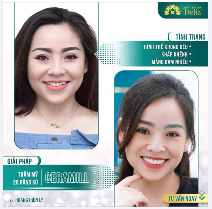 Tay nghề bác sĩ có thể quyết định đến 99% thành công của ca thẩm mỹ răng sứ.