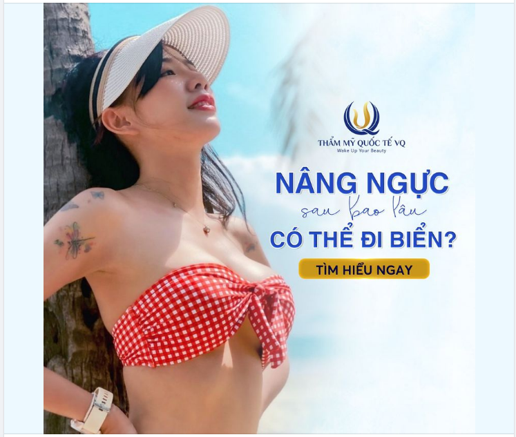Tháng 7 nâng ngực mà tháng 8 lại có lịch đi biển thì phải làm sao nhỉ