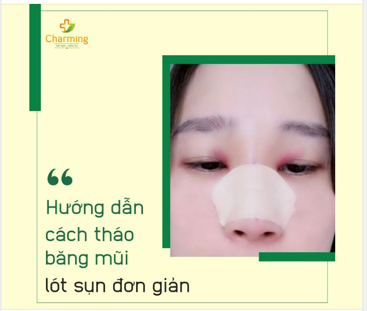 THÁO BĂNG TẠI NHÀ TƯỞNG KHÓ, HÓA DỄ CÙNG CHARMING