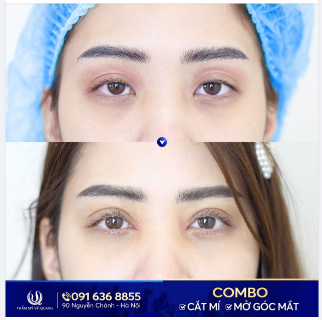 Thay đổi ngoạn mục - Trẻ lại đến 10 tuổi