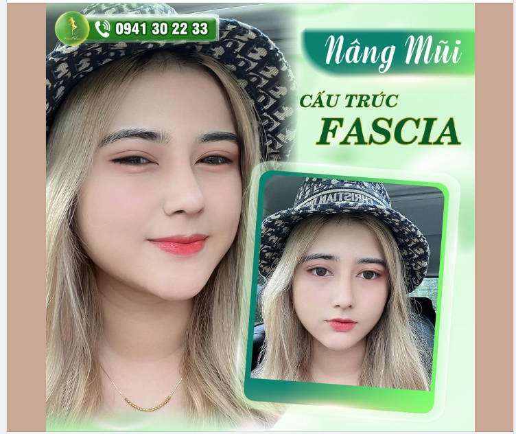 THAY ĐỔI NGOẠN MỤC VỚI MŨI CẤU TRÚC FASCIA