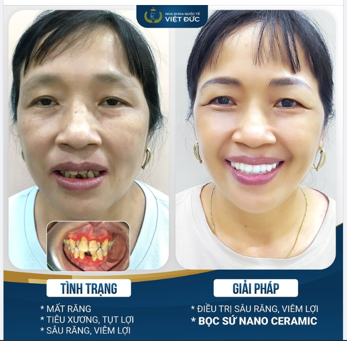 THAY ĐỔI NỤ CƯỜI - THAY ĐỔI CUỘC SỐNG