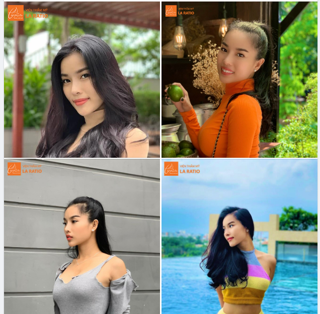 THẾ NÀO LÀ SỐNG MŨI ĐẸP