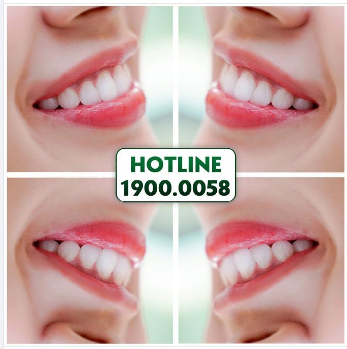 THỎA SỨC KHOE ĐƯỜNG CƯỜI HOÀN MỸ CÙNG NHA KHOA GIA ĐÌNH
