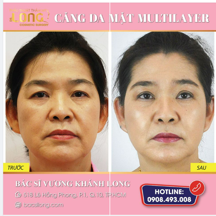 THOÁT KHỎI NẾP NHĂN - DA CĂNG TRÀN SỨC SỐNG️