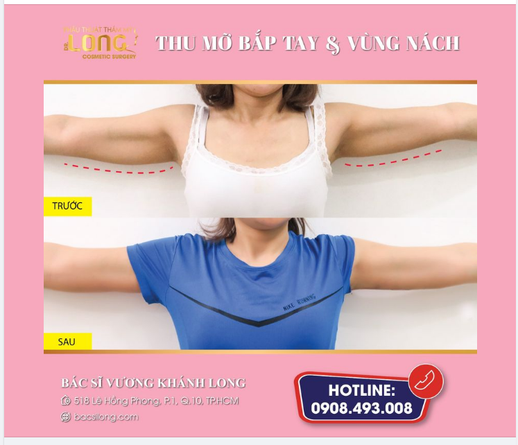 Thu gọn ngay chứ còn sao nữa, cánh tay to là khuyết điểm lớn của phái đẹp.