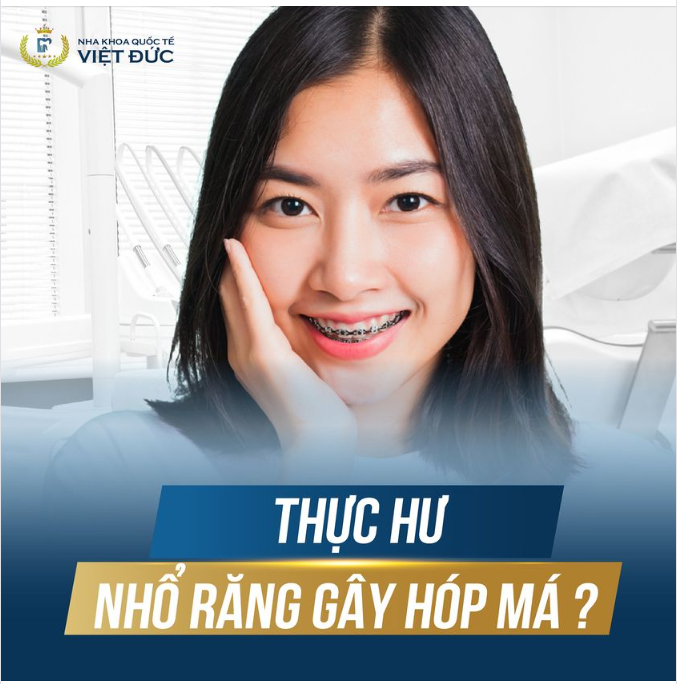 THỰC HƯ VẤN ĐỀ NHỔ RĂNG CHỈNH NHA GÂY HÓP MÁ?