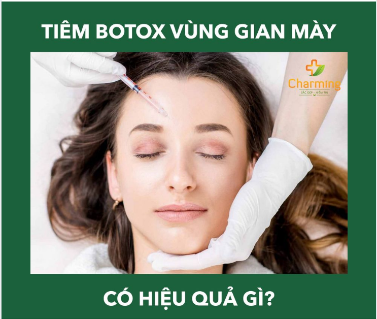 TIÊM BOTOX VÙNG GIAN MÀY CÓ HIỆU QUẢ GÌ