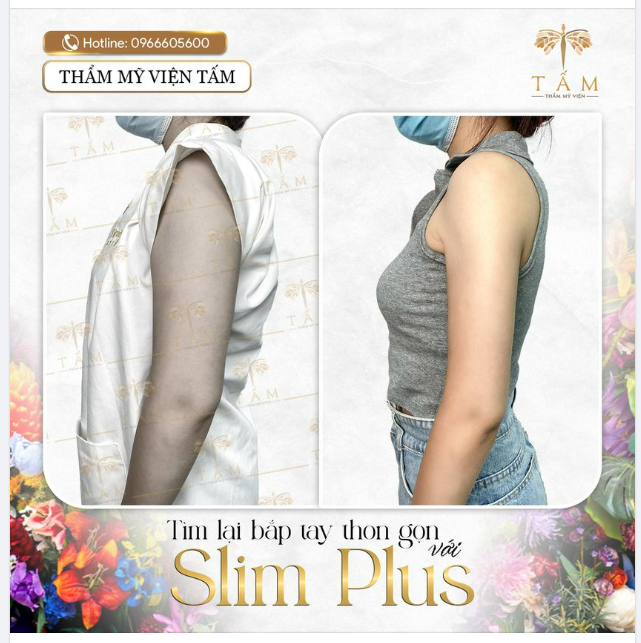 Tìm lại bắp tay thon gọn với Slim Plus