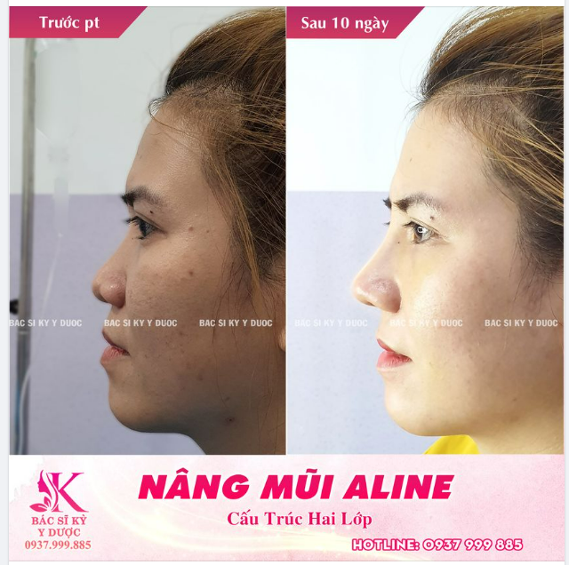 Tin tưỏng Kỳ và cái kết sau 10 ngày