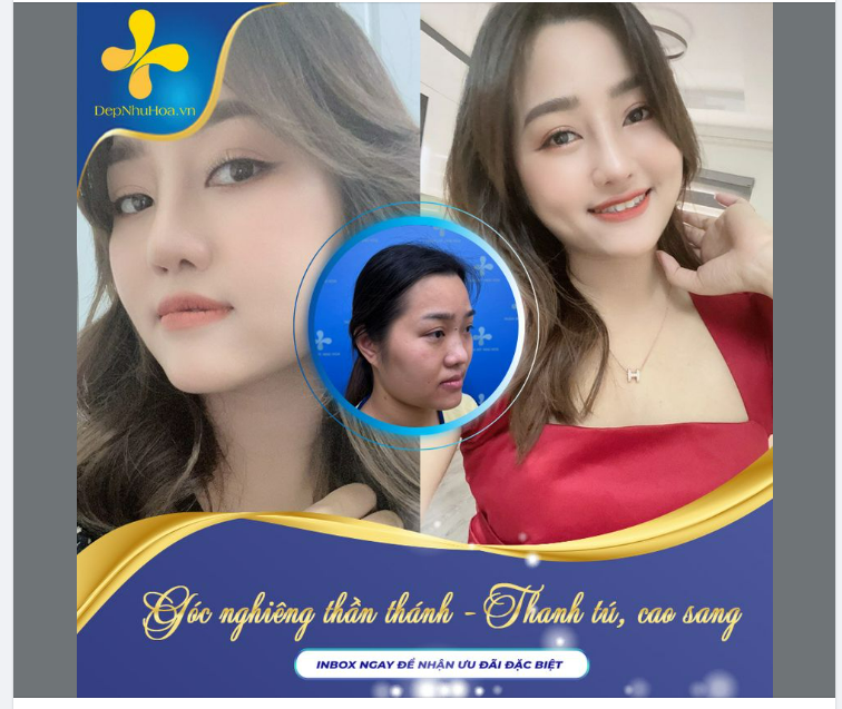 TÔI ĐÃ HỐI HẬN VÌ NÂNG MŨI...............QUÁ MUỘN!