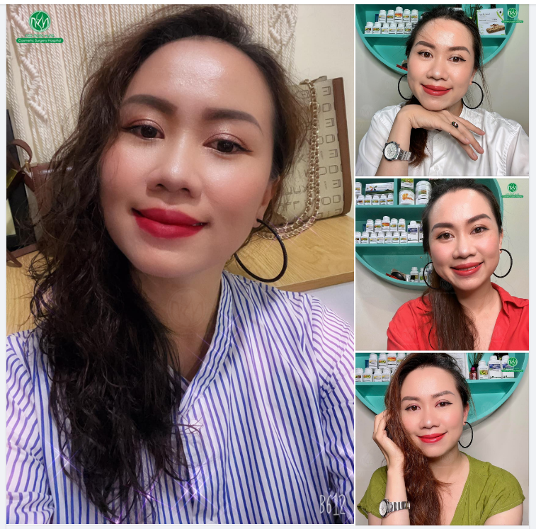 TRẺ TRUNG VÀ XINH ĐẸP HƠN VỚI ĐÔI MẮT 2 MÍ RẠNG NGỜI