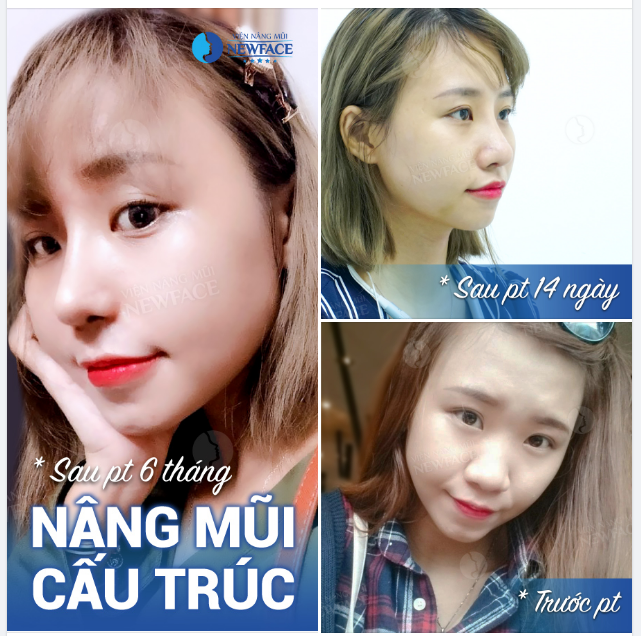Trên đời nhiều lắm chữ ngờ. Một trong số đó là ngờ on ngon….!