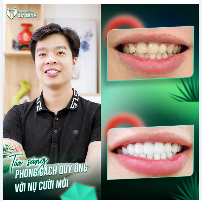 TRỞ THÀNH QUÝ ÔNG SANG TRỌNG VỚI NỤ CƯỜI CUỐN HÚT