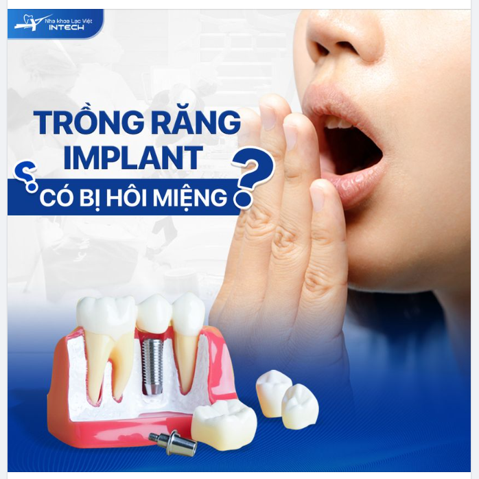 TRỒNG RĂNG IMPLANT CÓ BỊ HÔI MIỆNG KHÔNG