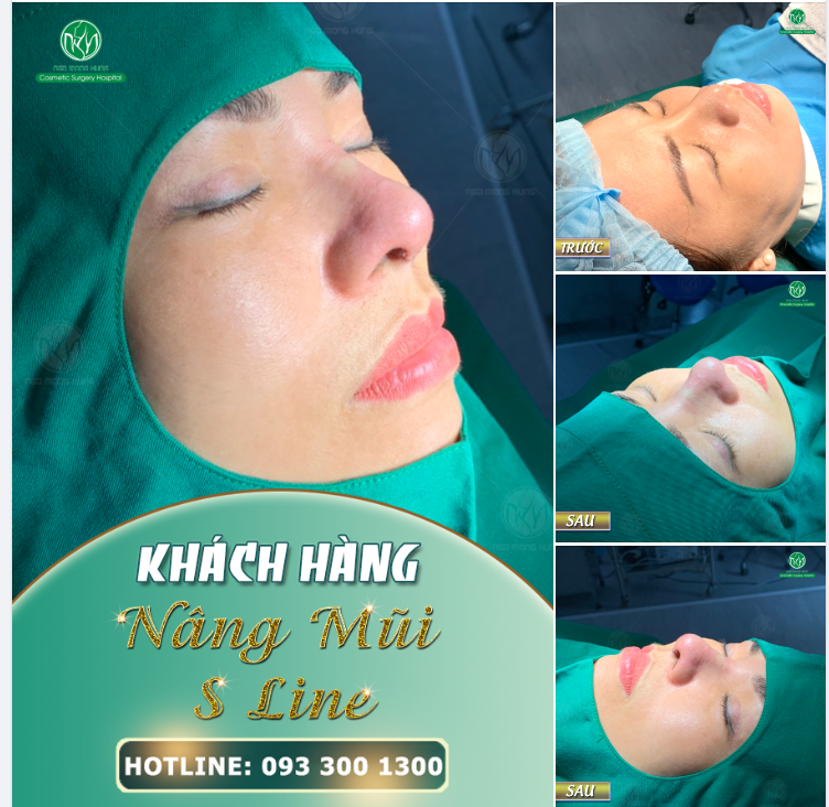 TRỰC TIẾP DÁNG MŨI S LINE VỪA HOÀN THÀNH