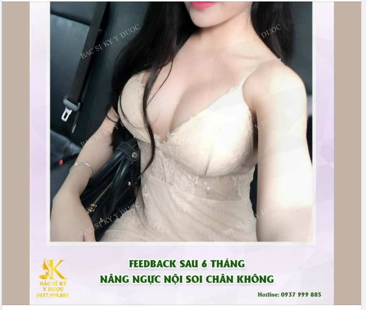 Tự hào góp phần vào vẻ đẹp hoàn hảo này