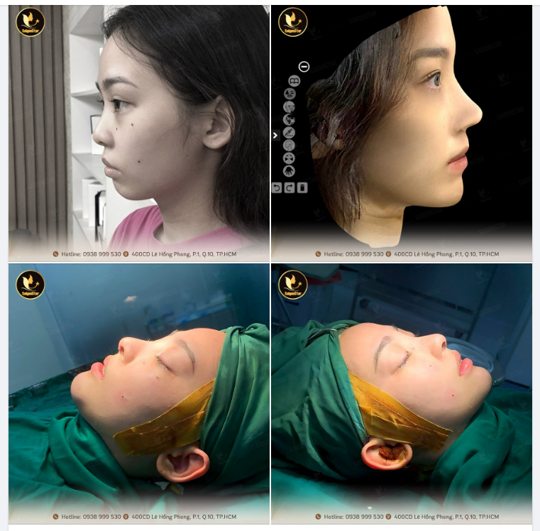 TỪ HÌNH ẢNH 3D ĐẾN THỰC TẾ