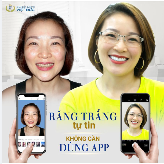 TỰ TIN TỎA SÁNG MỌI KHUNG HÌNH, KHÔNG CẦN APP
