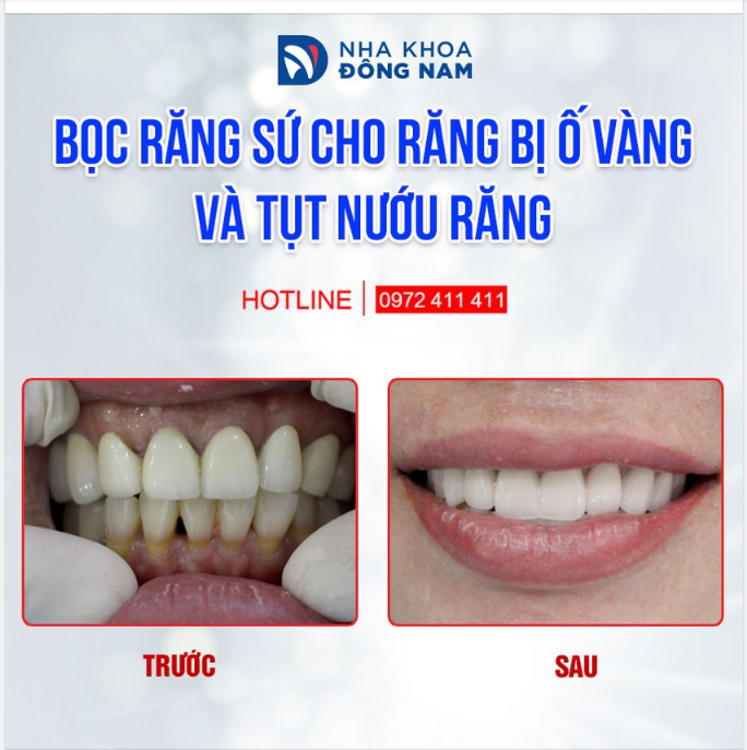 VẪN LÀ BẠN NHƯNG Ở MỘT PHIÊN BẢN TỰ TIN HƠN VỚI NỤ CƯỜI KHỎE - ĐẸP