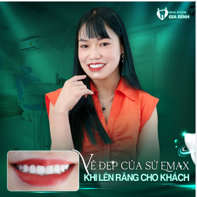VẺ ĐẸP CỦA SỨ CHỈ KHI LÊN RĂNG MỚI THẤY HẾT ĐƯỢC