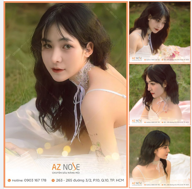 Vẻ đẹp ngọt ngào của nàng 2K sau 1 năm nâng mũi