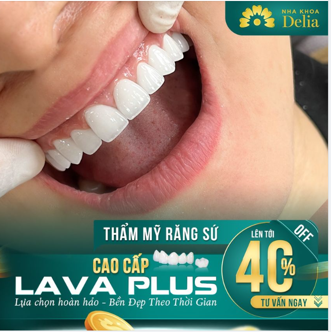 Vẻ đẹp tiêu chuẩn thẩm mỹ răng sứ