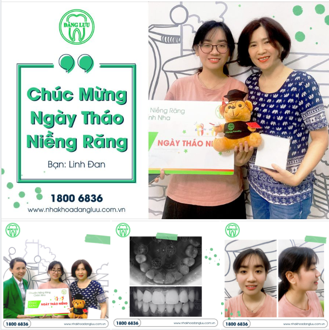 Vì nụ cười thiện cảm chính là cầu nối cho mọi mối quan hệ thêm gần gũi.