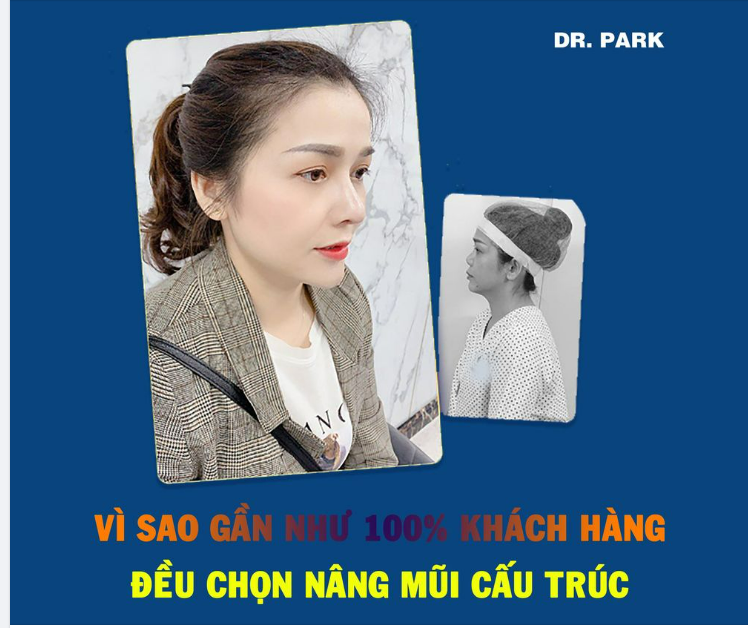 VÌ SAO GẦN NHƯ 100% KHÁCH HÀNG ĐỀU CHỌN NÂNG MŨI CẤU TRÚC