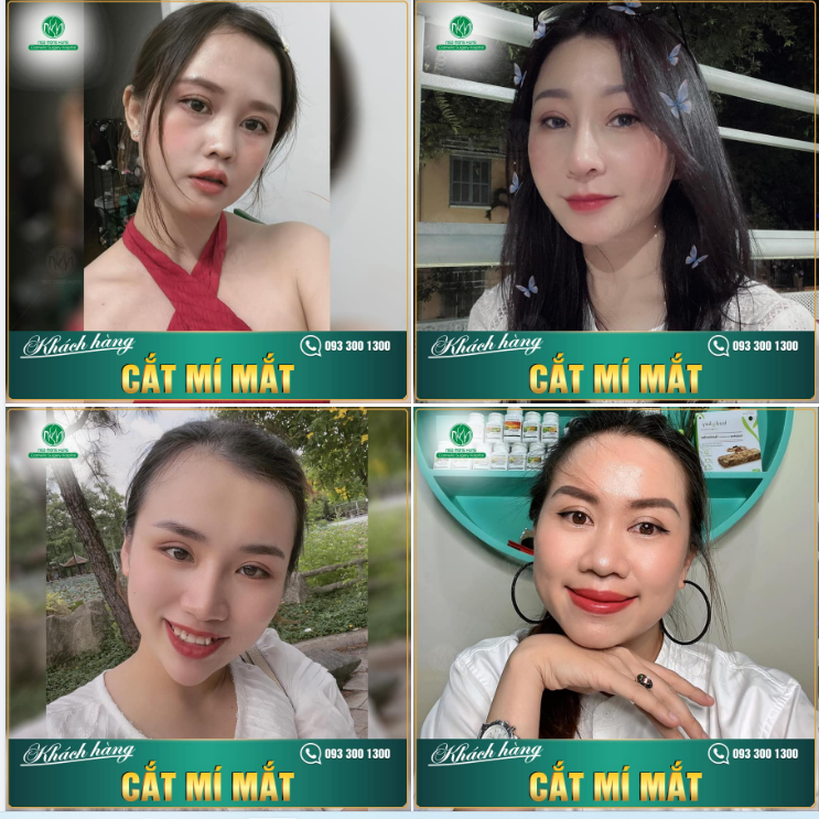 Với sứ mệnh làm đẹp cho người, làm đẹp cho đời. Bệnh viện Thẩm mỹ Ngô Mộng Hùng luôn cố gắng đem đến hiệu quả thẩm mỹ cao nhất cho từng khách hàng.