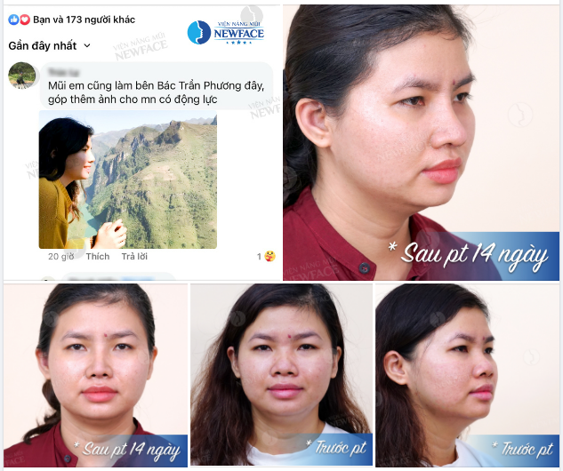 Vũ Trụ Đang Gởi Tín Hiệu Gì Mà Dạo Này Toàn Feedback “Xịn”!!!