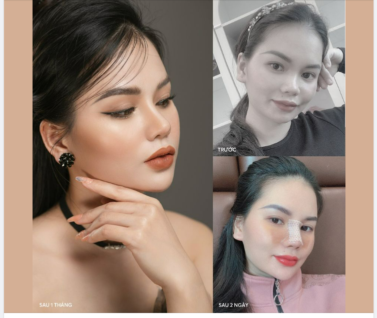 Xinh đẹp cũng là một loại lựa chọn !!