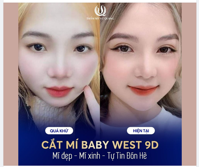 Xinh đẹp hơn bội phần chỉ nhờ 1 thay đổi nhỏ ở đôi mắt