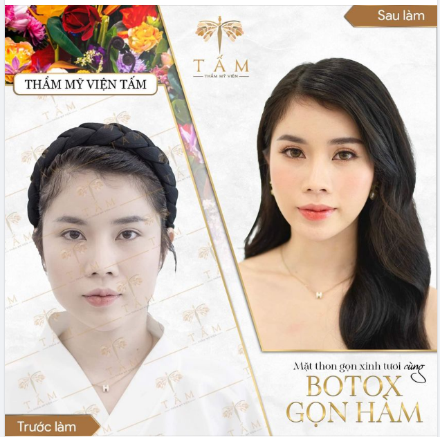 XOÁ BỎ SỰ TỰ TI VÌ HÀM TO BẠNH