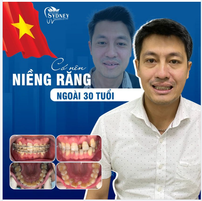 30 CHƯA PHẢI LÀ HẾT!