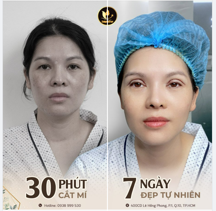 30 PHÚT CẮT MÍ – 7 NGÀY ĐẸP TỰ NHIÊN