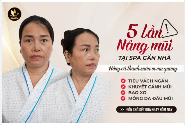 5 LẦN NÂNG MŨI SPA GẦN NHÀ HỎNG CẢ THANH XUÂN VÌ “MÙ QUÁNG”