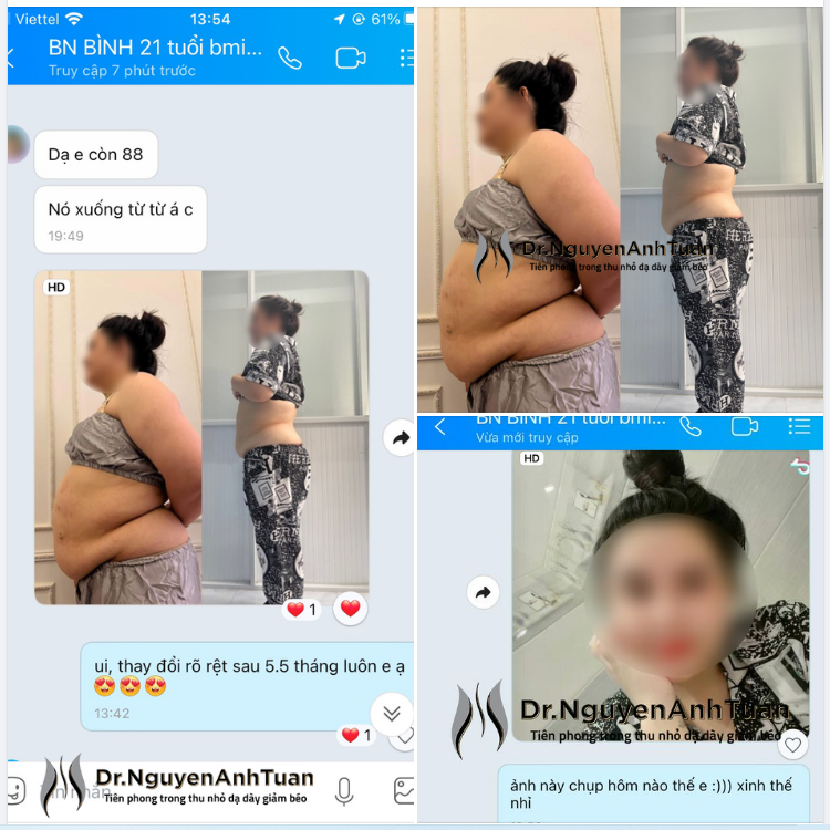 5,5 tháng giảm 22kg. Đây là kết quả giảm cân của một bệnh nhân đến từ khu vực phía Nam của chúng tôi.
