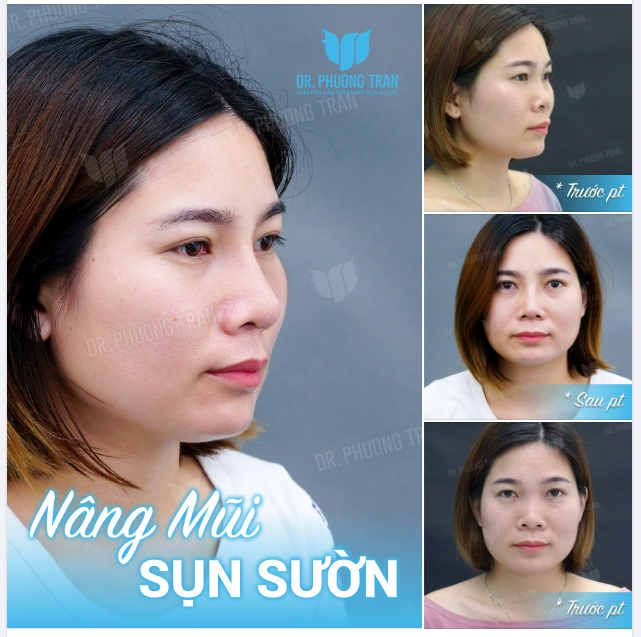 Anh có yêu bản thân mình hông, nếu có làm tình địch với em nhá....