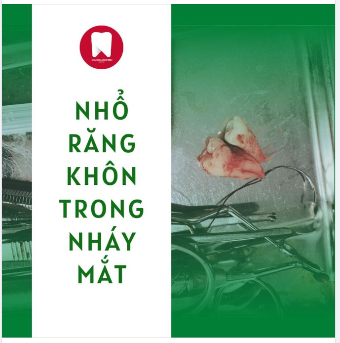 ANH EM NƯƠNG TỰA - PHẢI NHỔ BỎ NGAY