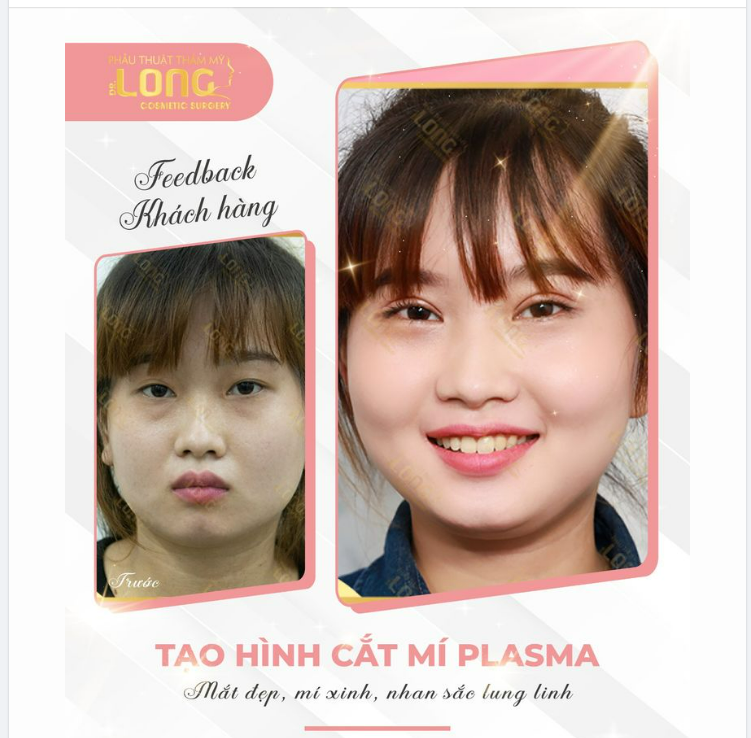 Ánh mắt “biết nói” đang kêu gào chủ nhân hãy tìm ngay phương pháp CỨU NGUY