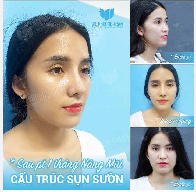 Anh vốn thích cuộc đời phiên bạt. Ai ngờ đi lạc vào trong mắt em…!
